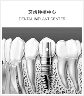 牙齿种植中心